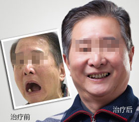 天津東麗區無痛人流醫院