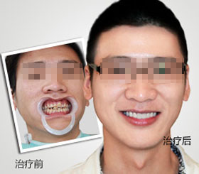 天津東麗區無痛人流醫院