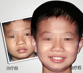 天津東麗區無痛人流醫院