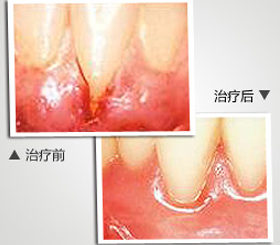 天津東麗區無痛人流醫院